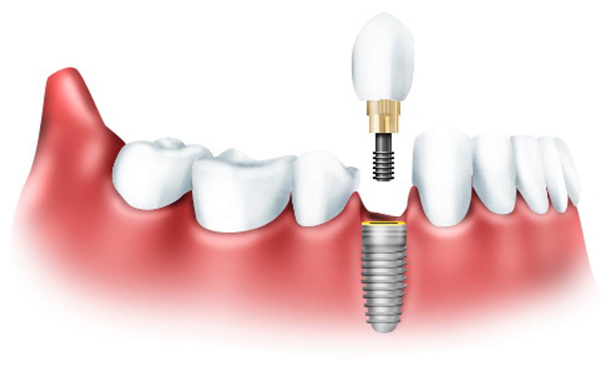 LASER DENTAL CLINIC